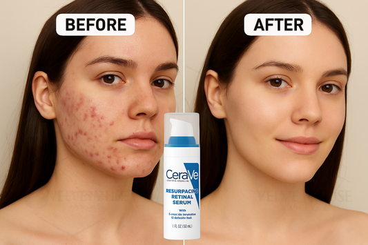 CeraVe Psoriasis Moisturizing Cream – 8 oz